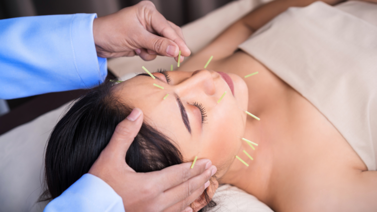 A woman received acupuncture in her face.
