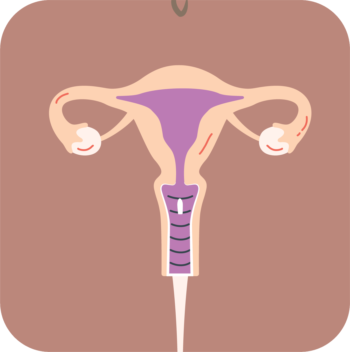 How a vaginal suppository works - absorb step