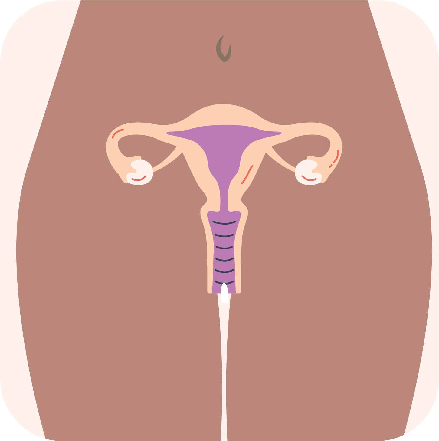 How a vaginal suppository works - insert step
