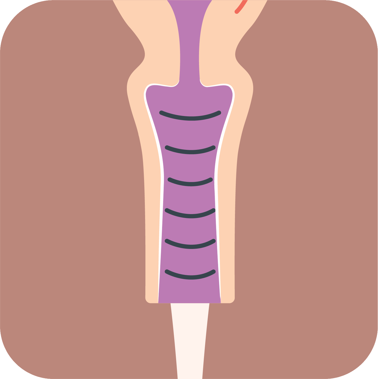 How a vaginal suppository works - relief step